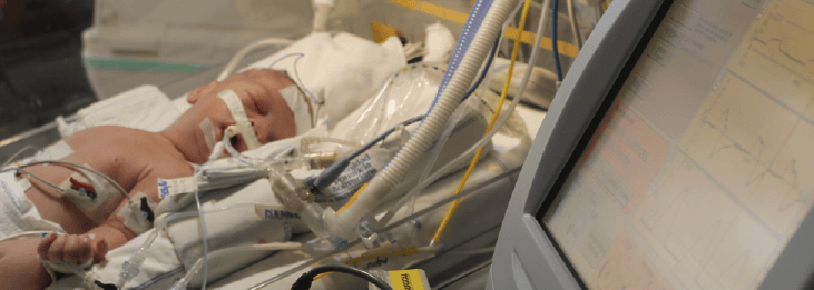 Cuidados en la estabilización y transporte del paciente neonata extremo 