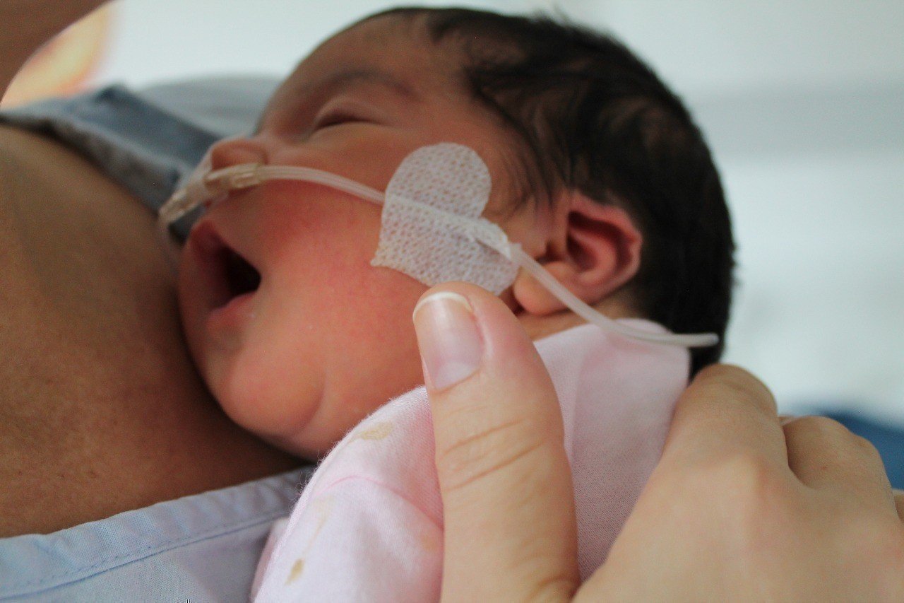 Fibrosis quistica en bebes