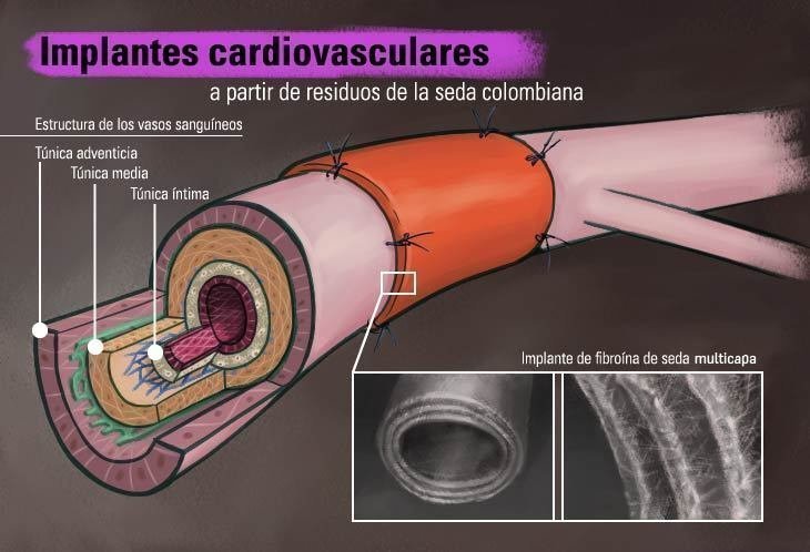 Implantes vasculares a partir de residuos de la seda colombiana 