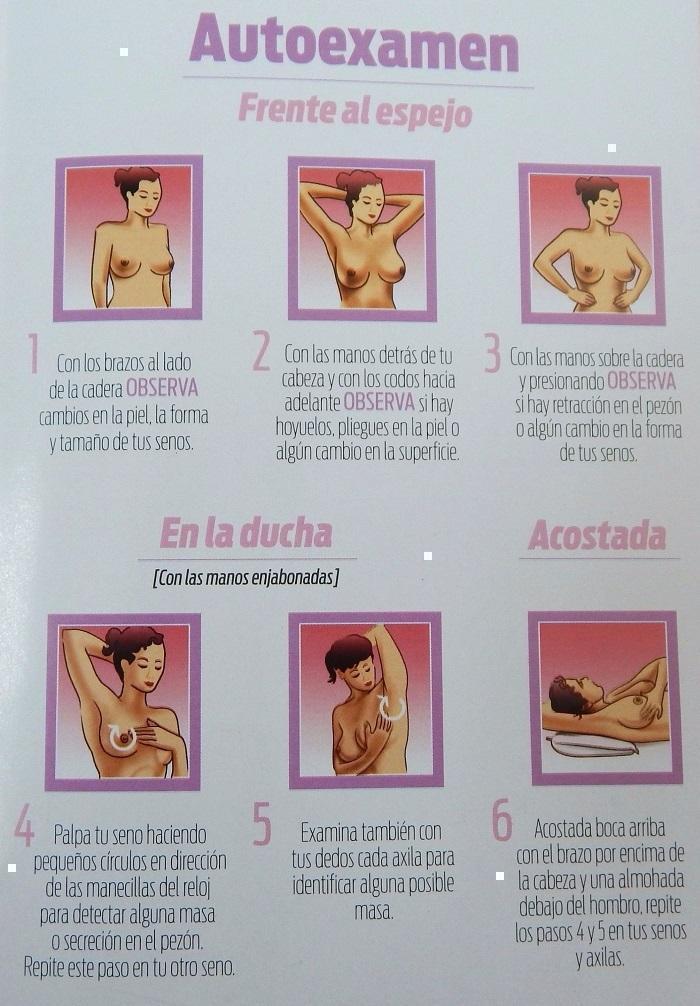 CANCER DE MAMA